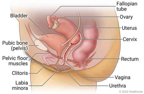 Stages of uterine prolapse. Pelvic floor muscles weakening, Support Stock  Vector